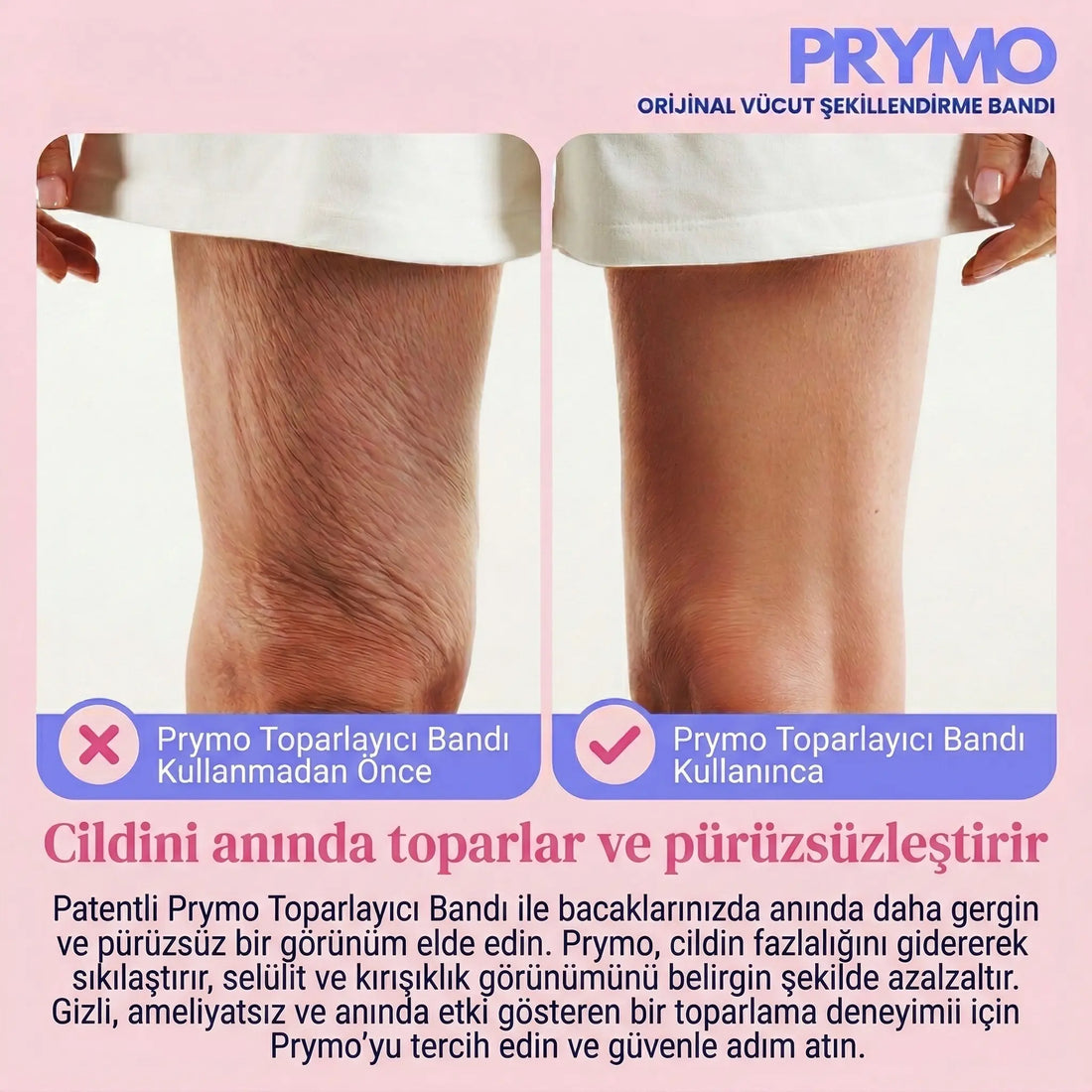 Pürüzsüzleştirici & Sıkılaştırıcı Selülit Bandı