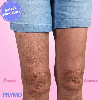 Pürüzsüzleştirici & Sıkılaştırıcı Selülit Bandı