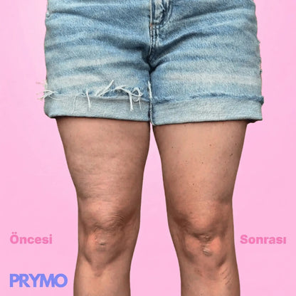 Pürüzsüzleştirici & Sıkılaştırıcı Selülit Bandı